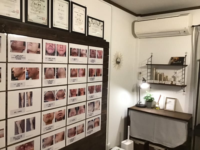 脱毛サロン Men's YUSYURE(大和市)