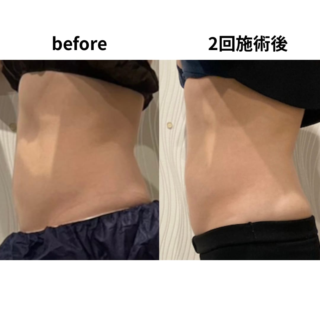脱毛・エステ Dahlia Beauty（春日井）のメンズ眉毛サロン店内写真 1枚目