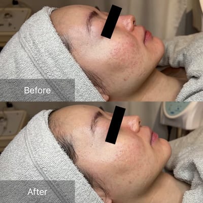 医療提携サロンLino沼津 シミケア・脱毛・眉毛 店内写真 3枚目