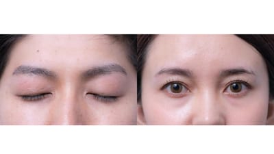 一度脱毛した眉毛はケア要らず次世代アイブロウ・眉毛脱毛研究所 MDラボ大垣店 店内写真 2枚目